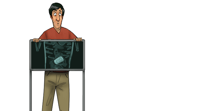 In the medical test, they found a tin (intestine) of beans in my tube shaped digestive organs.